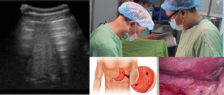 Khoa Ngoại Tổng Hợp: Phẫu Thuật Cấp Cứu Kịp Thời Cứu Sống 9 Bệnh Nhân Bị Thủng Tạng Rỗng